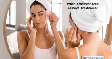What is the best acne removal treatment?